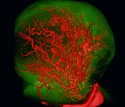 Three-dimensional micro-CT image of a bovine ovary showing the vasculature of the corpus luteum. Image: Dr. Jaswant Singh.