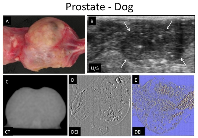Prostate images