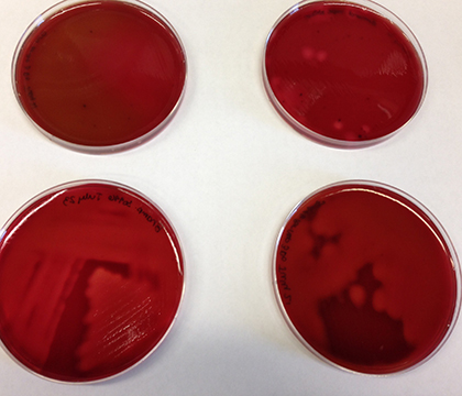 Research uses blood agar plates (shown above) to help characterize individual Brachyspira species.