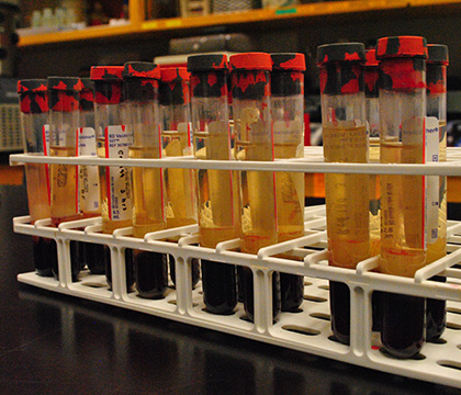 These tubes contain blood samples collected from sheep after exposure to ergot. After blood collection, the tubes are brought to the lab and centrifuged, which causes the serum (clear liquid) to separate from the blood cells (dark red clot at the bottom of the tubes). The serum was removed and stored in the freezer for further analysis at a later time, with the goal being to detect the concentration of ergot toxins using advanced diagnostics. Photo by Jair Gobbett.