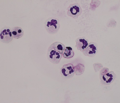 An up close look at neutrophils under the microscope. Photo by Jacqueline Harrison.