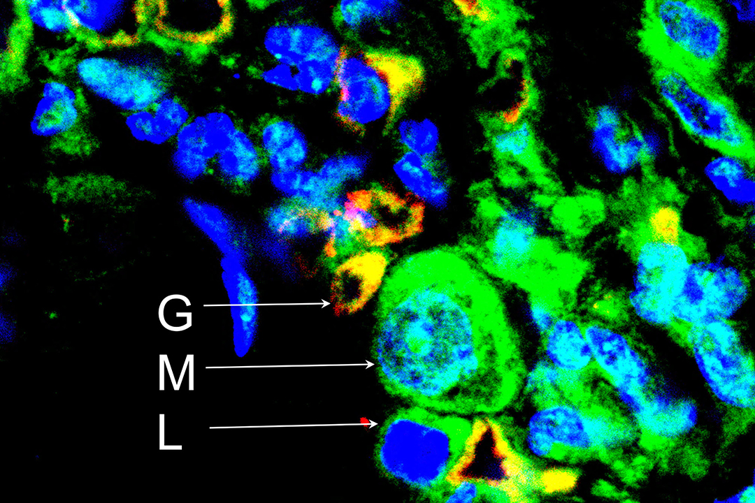 Cell party in asthmatic lung, by WCVM PhD student Nguyen Phuong Khanh Le. 