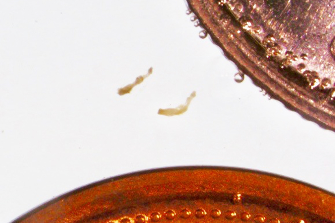 Small, but deadly: Echinococcus spp. compared to a penny and dime. Photo: Mila Bassil.
