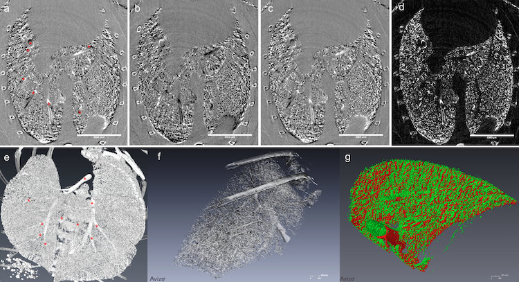 Images visualize damage in the lungs with high resolution. These images were produced by multiple-image radiography (MIR) using the synchrotron at the Canadian Light Source. Supplied image.