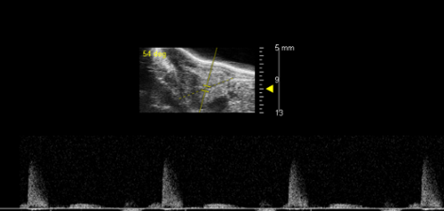 An ultrasound image showing a rainbow trout's heart function. Photo: Amy Taylor. 