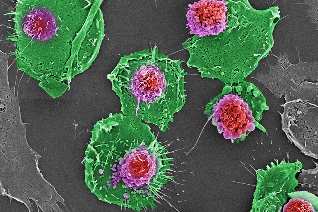This scanning electron microscopy image shows cultured gonocytes (progenitors of spermatogonial stem cells. Image: Dr. Awang Junaidi.  