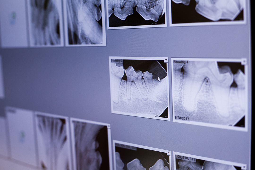 While X-rays are useful for revealing the common signs of dental disease, CT scans can alert a veterinarian to other signs — including changes to the lymph nodes. Photo: Christina Weese.