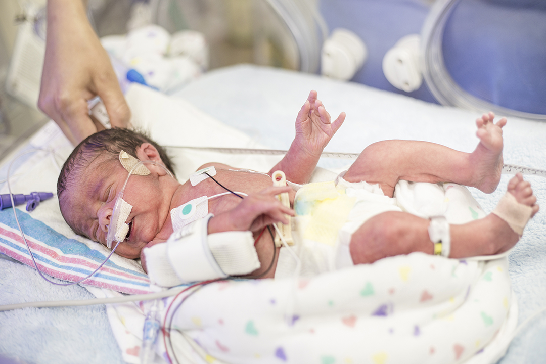 Nearly half of preterm births occur due to unknown causes and no effective method yet exists to predict or possibly prevent premature birth. Photo: iStockphoto.com.