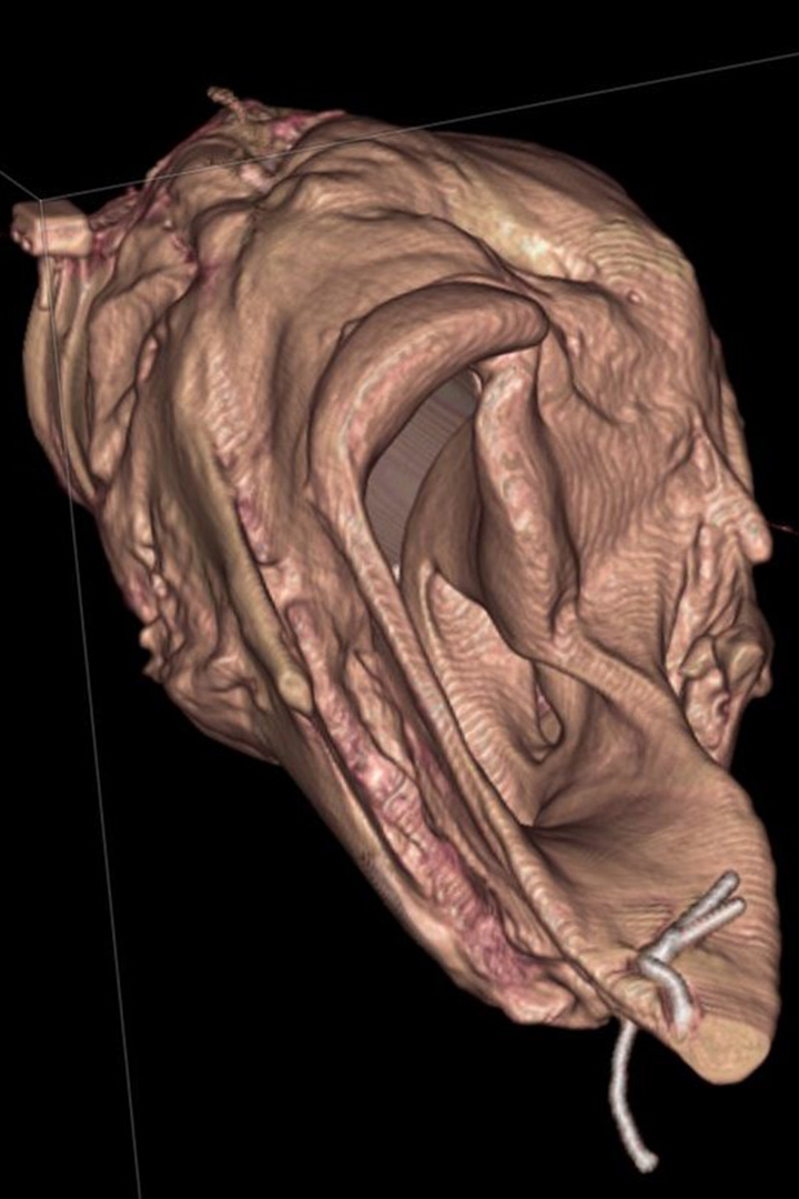 A three-dimensional reconstruction of a larynx model, created with the use of CT scans. Image supplied by Dr. Michelle Tucker.