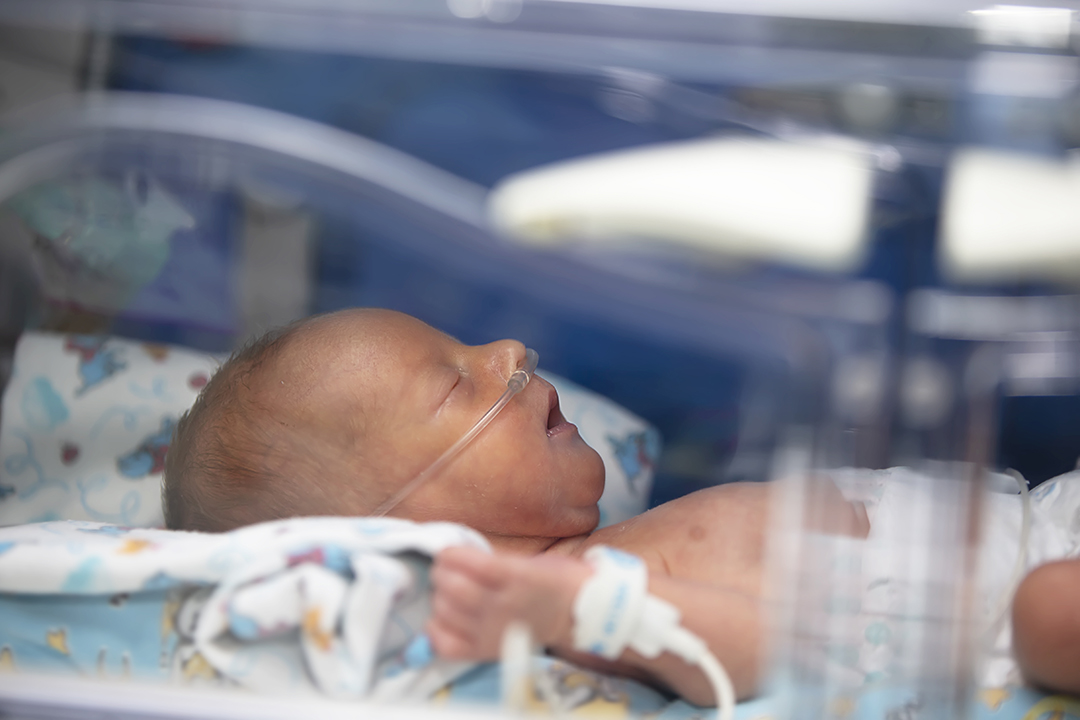 Closeup of premature baby