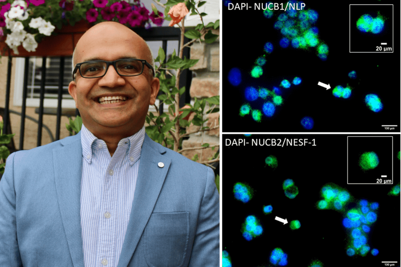 USask scientist Dr. Suraj Unniappan (left). At right is a micrograph showing nesfatin-1-like peptides (top, green) and nesfatin-1 (bottom, green) in human liver cells. Photos: submitted. 