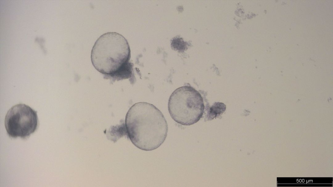 A microscopic view of trophoblastic vesicles (TRVs). Photo: Lynka Itogawa.