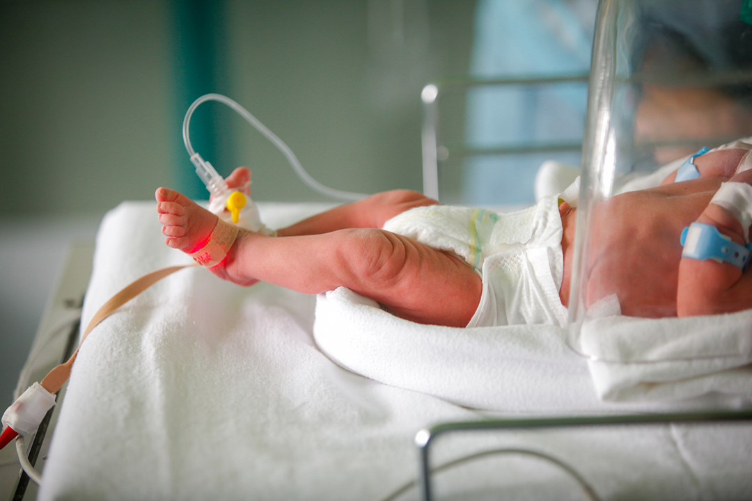 Preterm baby in the neonatal ICU.